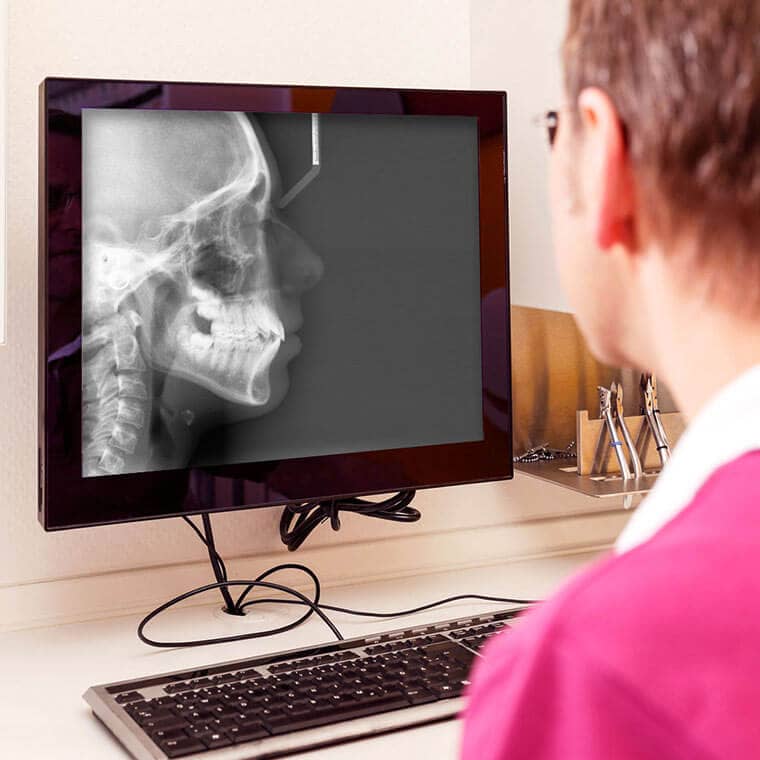Röntgenaufnahme auf einem Monitor